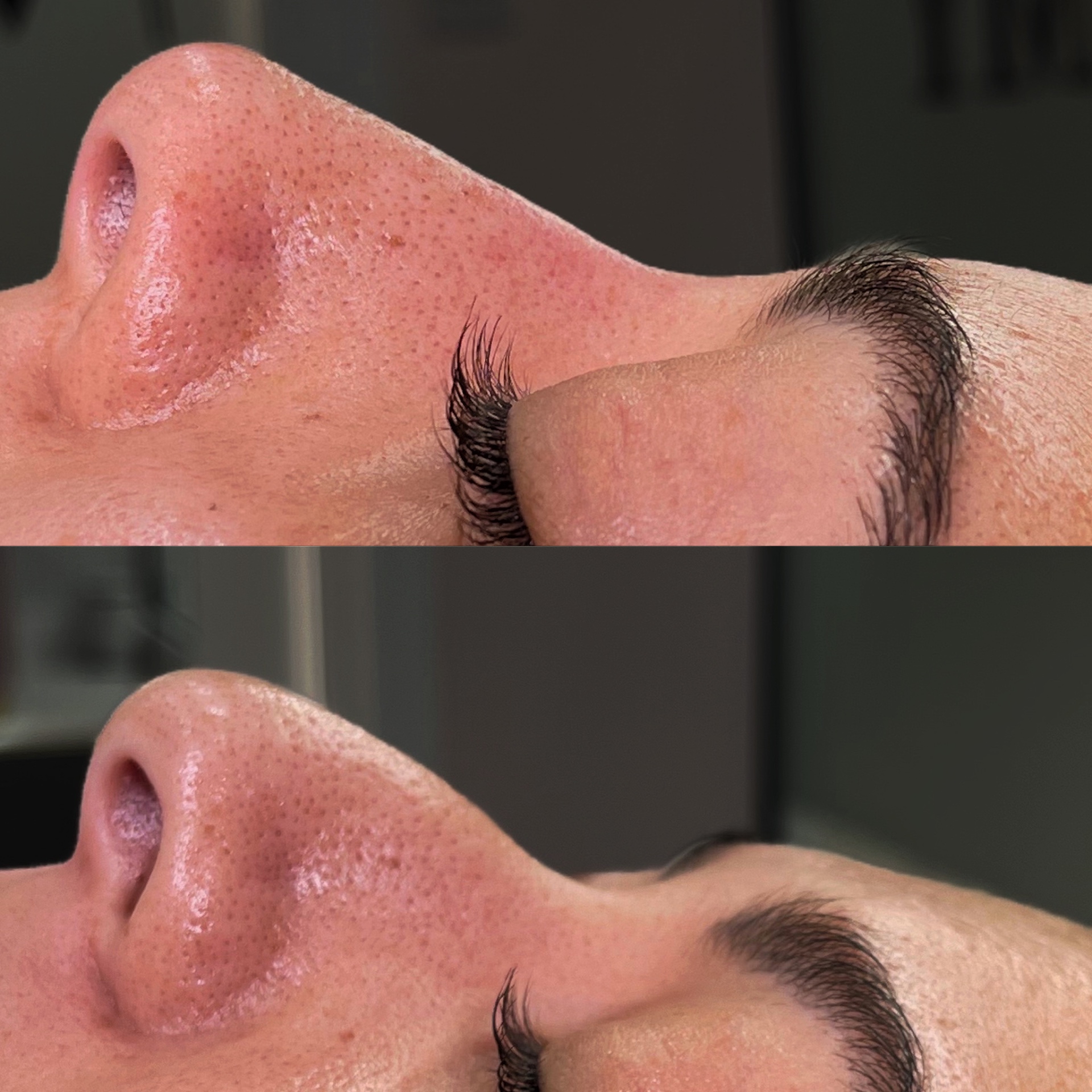 Before and after a deep cleansing skin treatment at Glossed